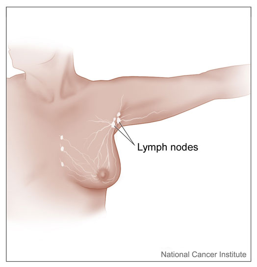 Lymph nodes location-NCI image_med