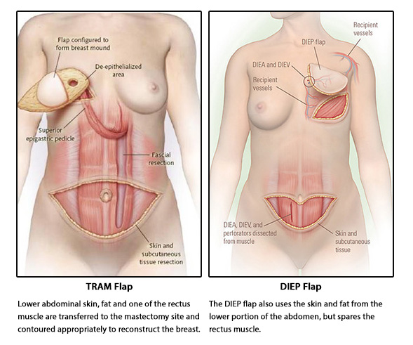 tram-flap-vs-diep-flap